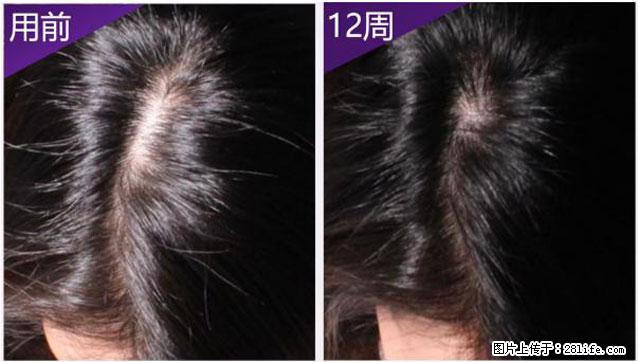防脱踩坑无数?内见蓝铜肽,才是脱发星人的救命成分! - 上海生活资讯 - 上海28生活网 sh.28life.com